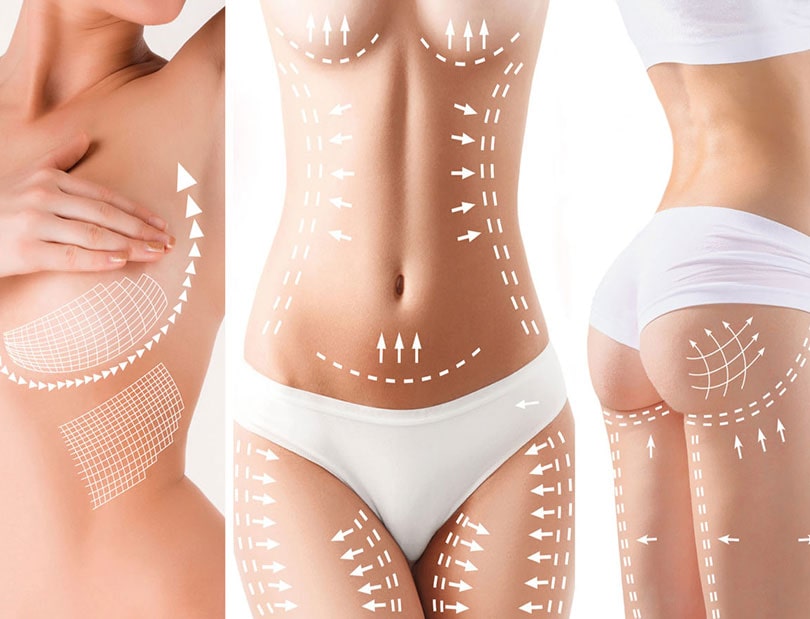Body-Shaping-Melbourne-Guide